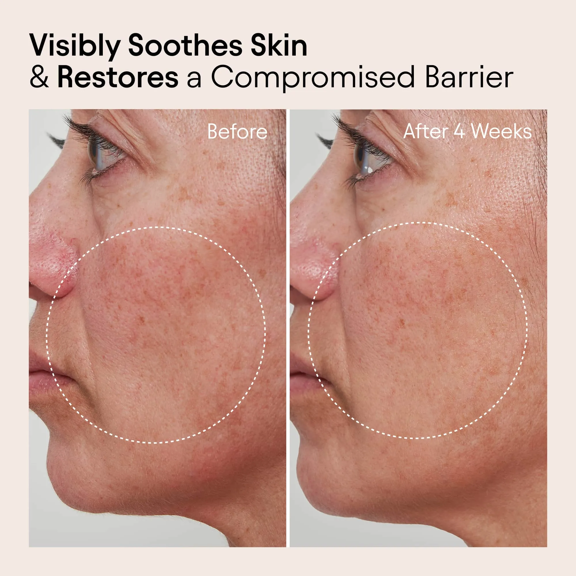Barrier Repair Cream