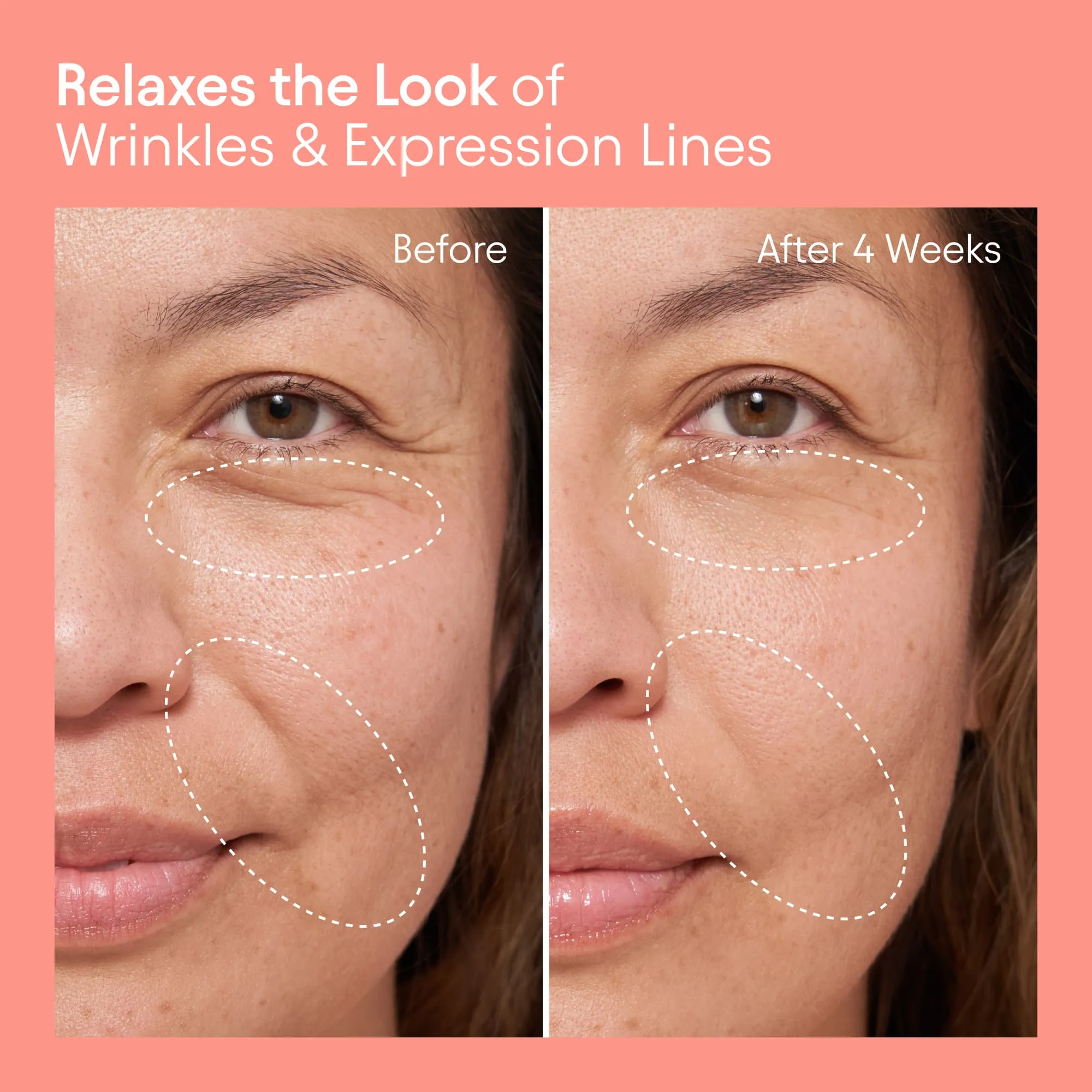 Barrier Repair Cream