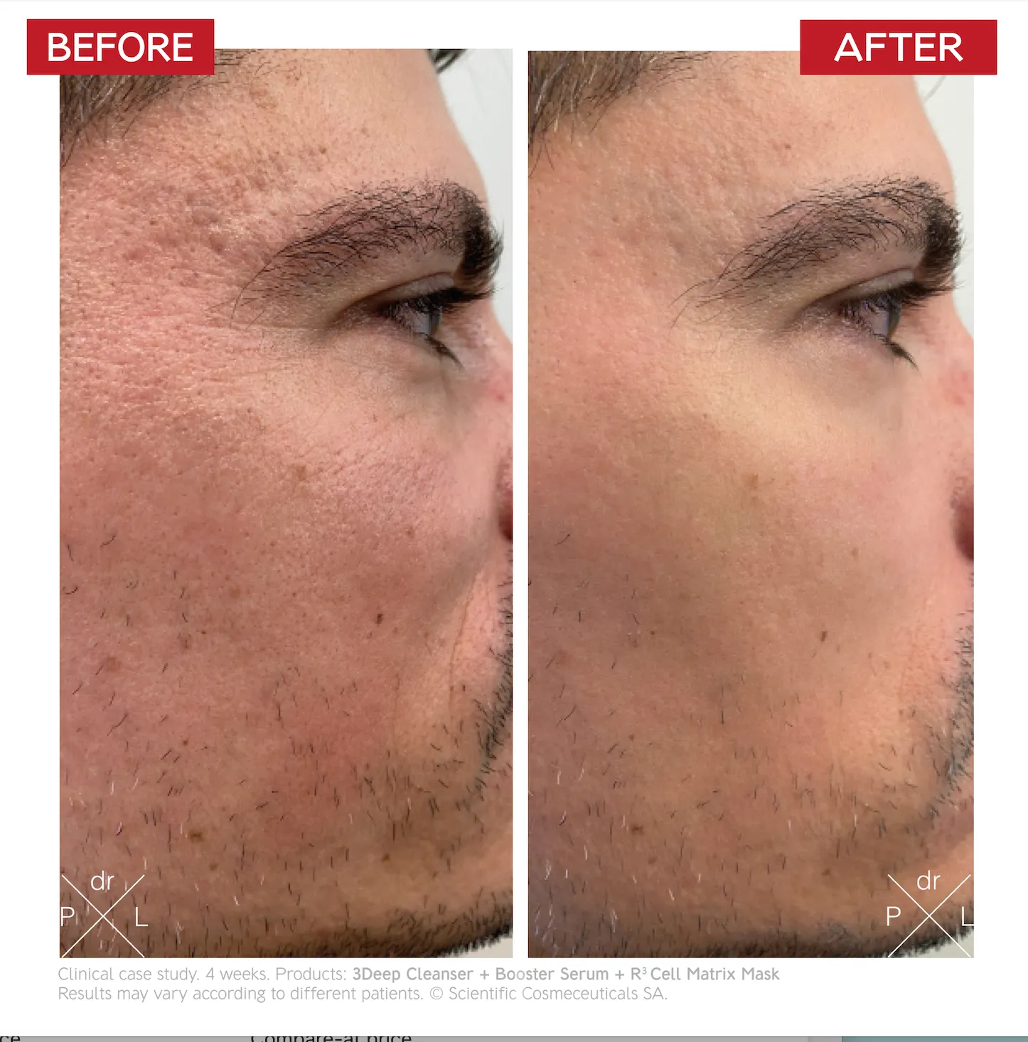 Booster Serum