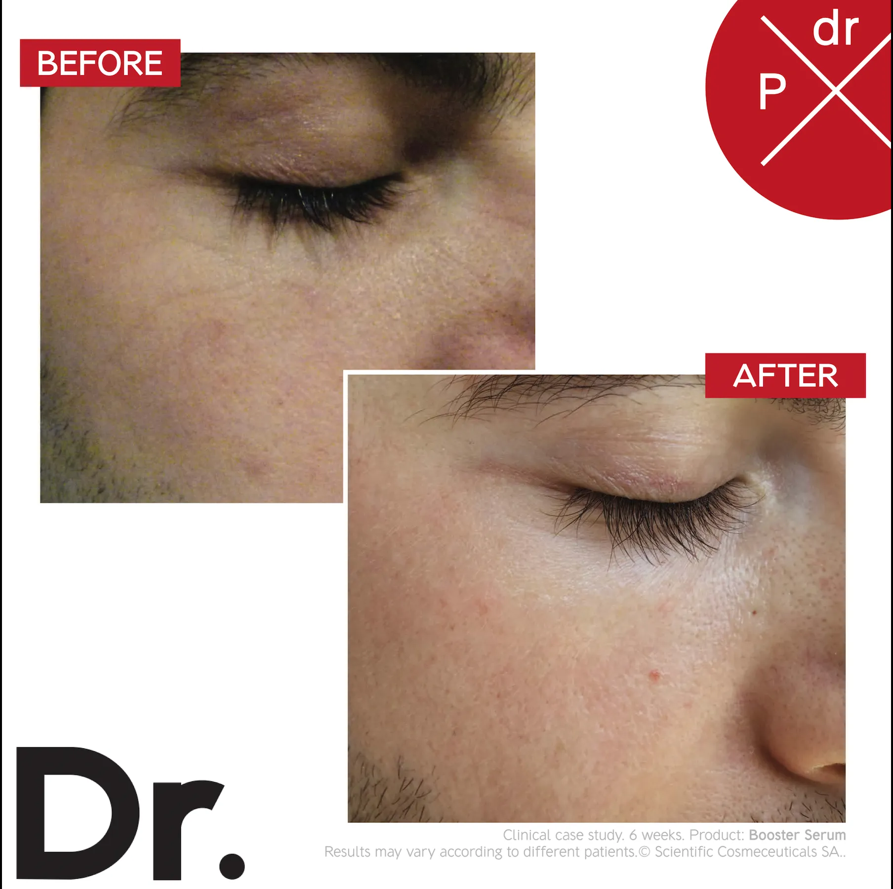 Booster Serum
