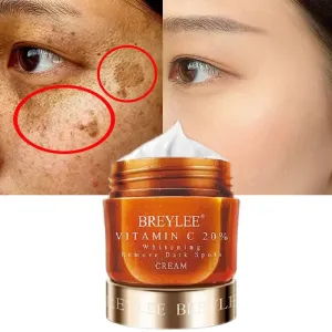BREYLEE Face Cream Vitamin C 20% Whitening Remove Dark Spots Facial Cream Repair Fade Freckls Melanin Remover Brighten Skin 40g