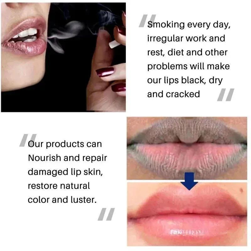 Brightening Balm for Lips