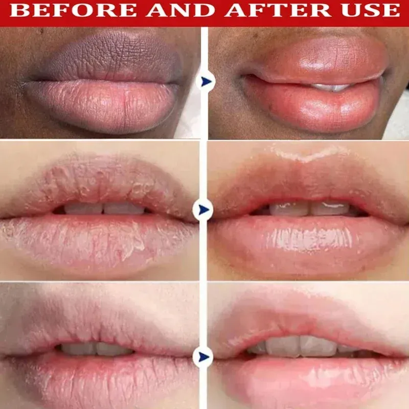 Brightening Balm for Lips