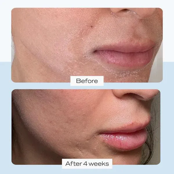 First Aid Beauty - Ultra Repair Cream Intense Hydration - 170g