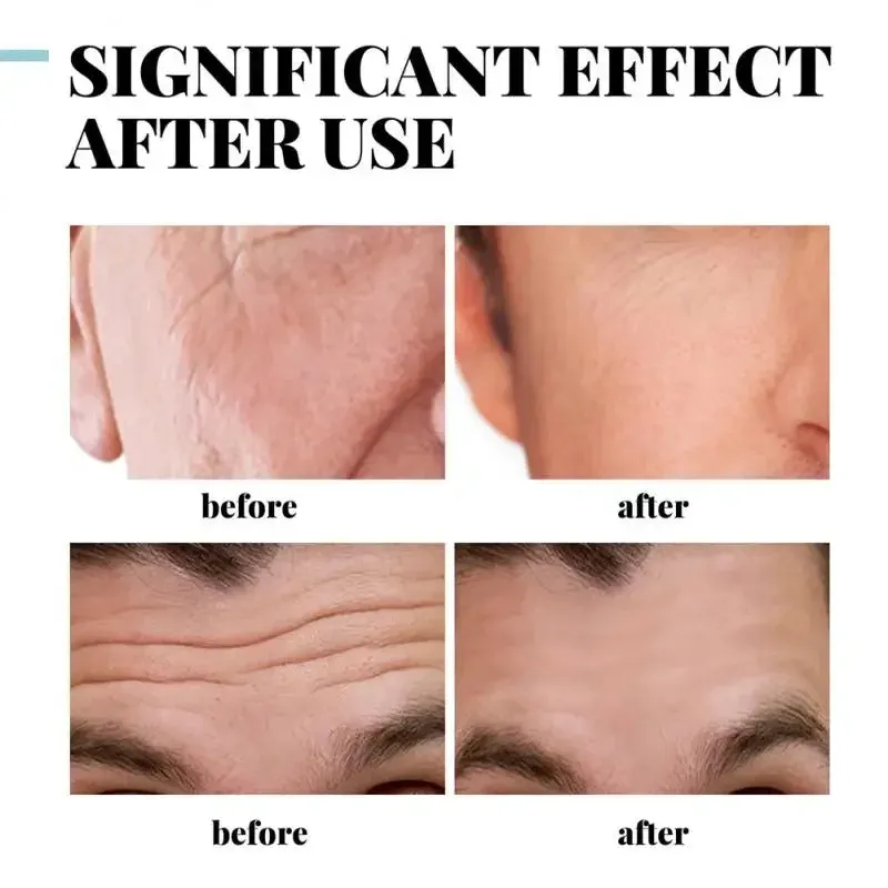 Men's Collagen Anti-Wrinkle Cream: Hyaluronic Formula to Remove Wrinkles, Firming, Lifting, Moisturizing, Anti-Aging, Whitening, Brightening Face Care.