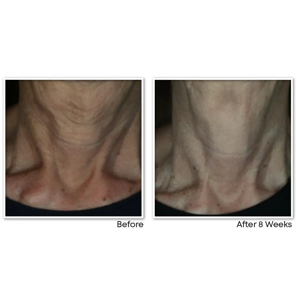 MULTI CORREXION® Crépe Repair Face & Neck Cream