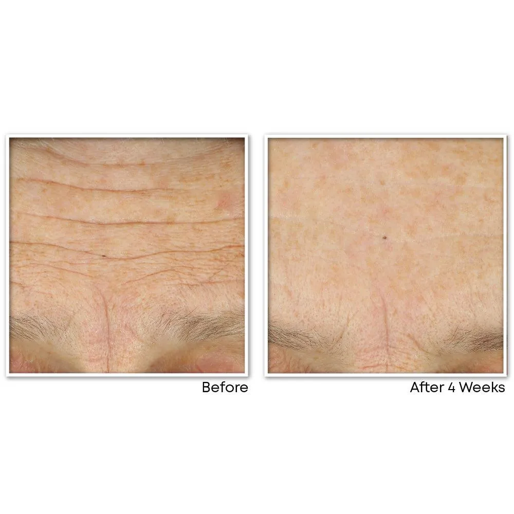 MULTI CORREXION® Crépe Repair Face & Neck Cream