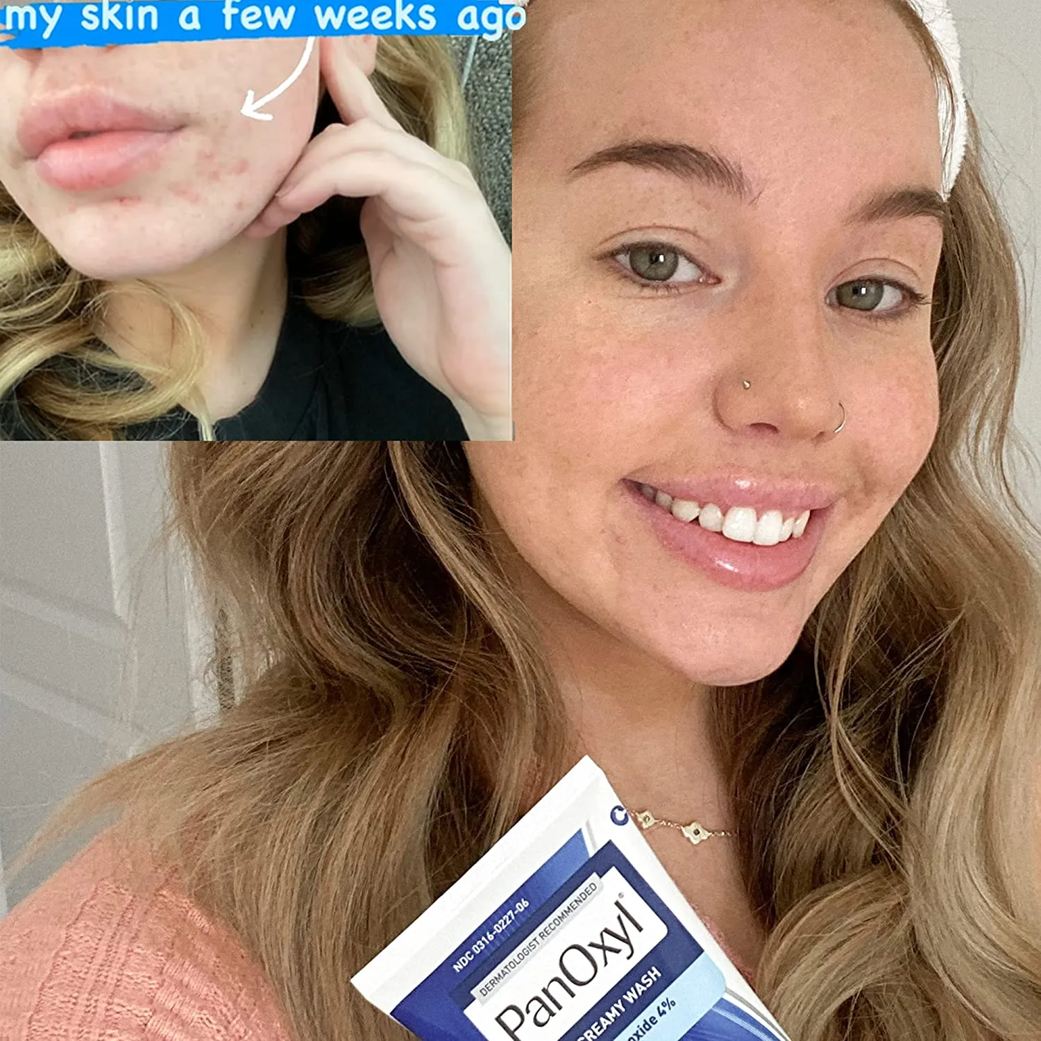 Panoxyl Acne Creamy Wash Benzoyl Peroxide 4% Daily Control