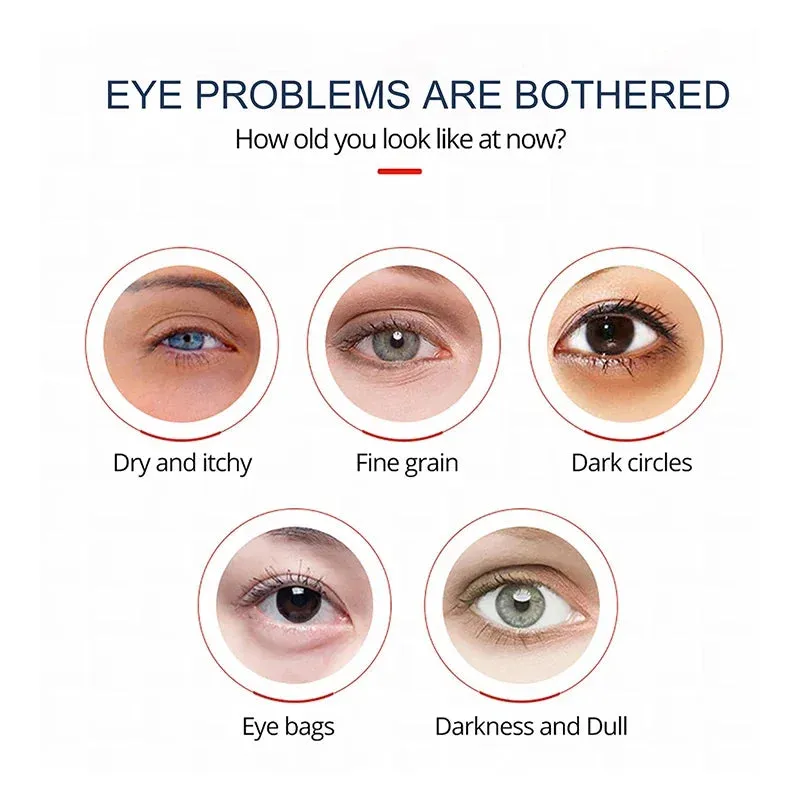 Retinol Anti-Wrinkle Eye Cream Dark Circles Eye Bags Remove Anti-Puffiness Fade Fine Lines Moisturizing Eye Care Original 2024