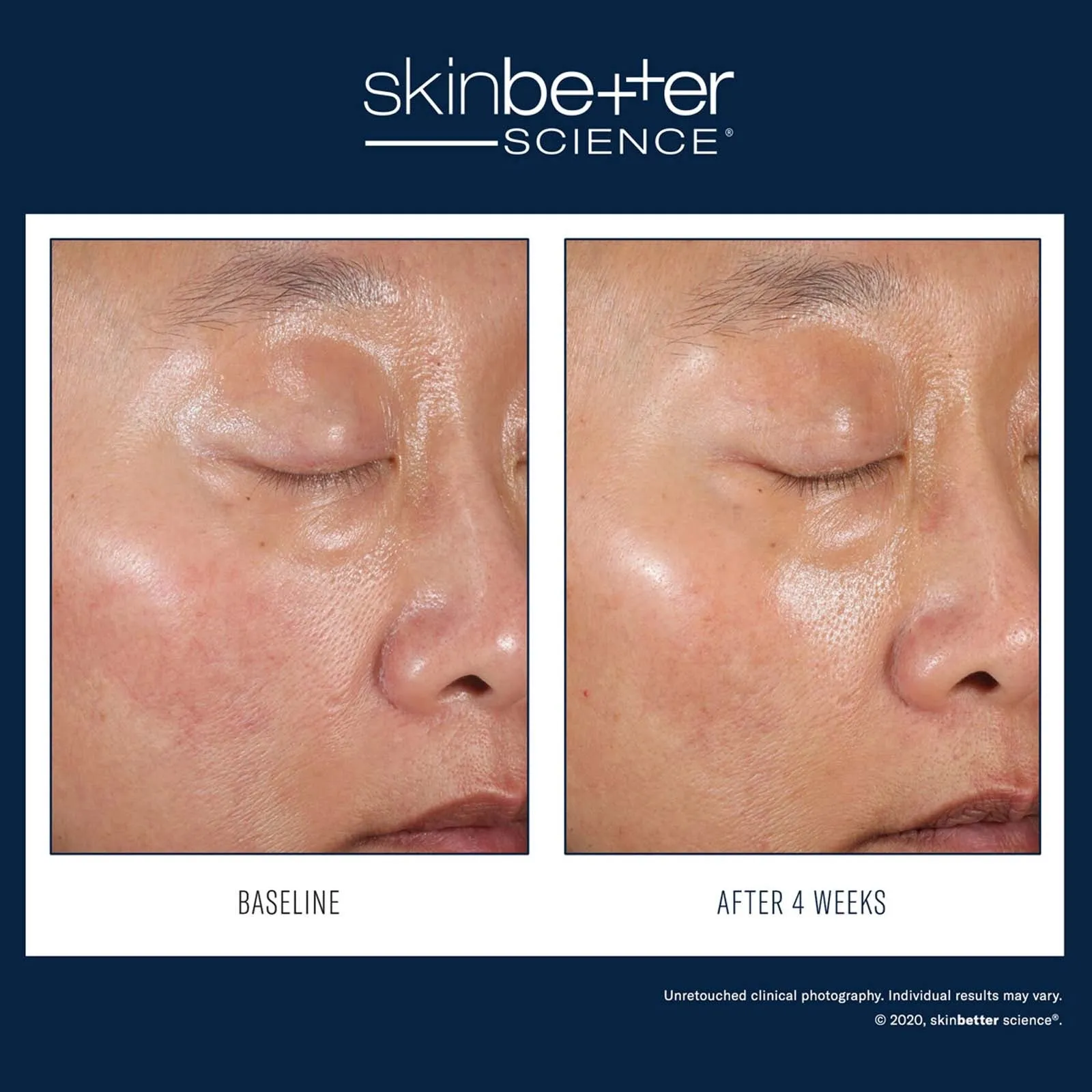 Skinbetter Science: Duo Kit 30ml