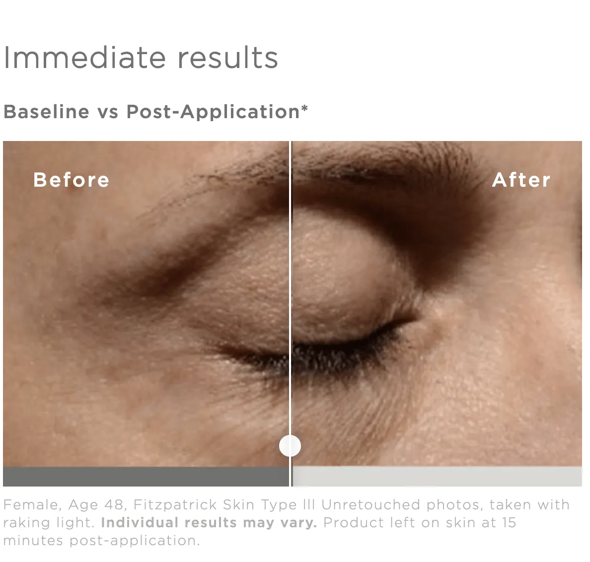 SkinMedica Instant Bright Eye Cream