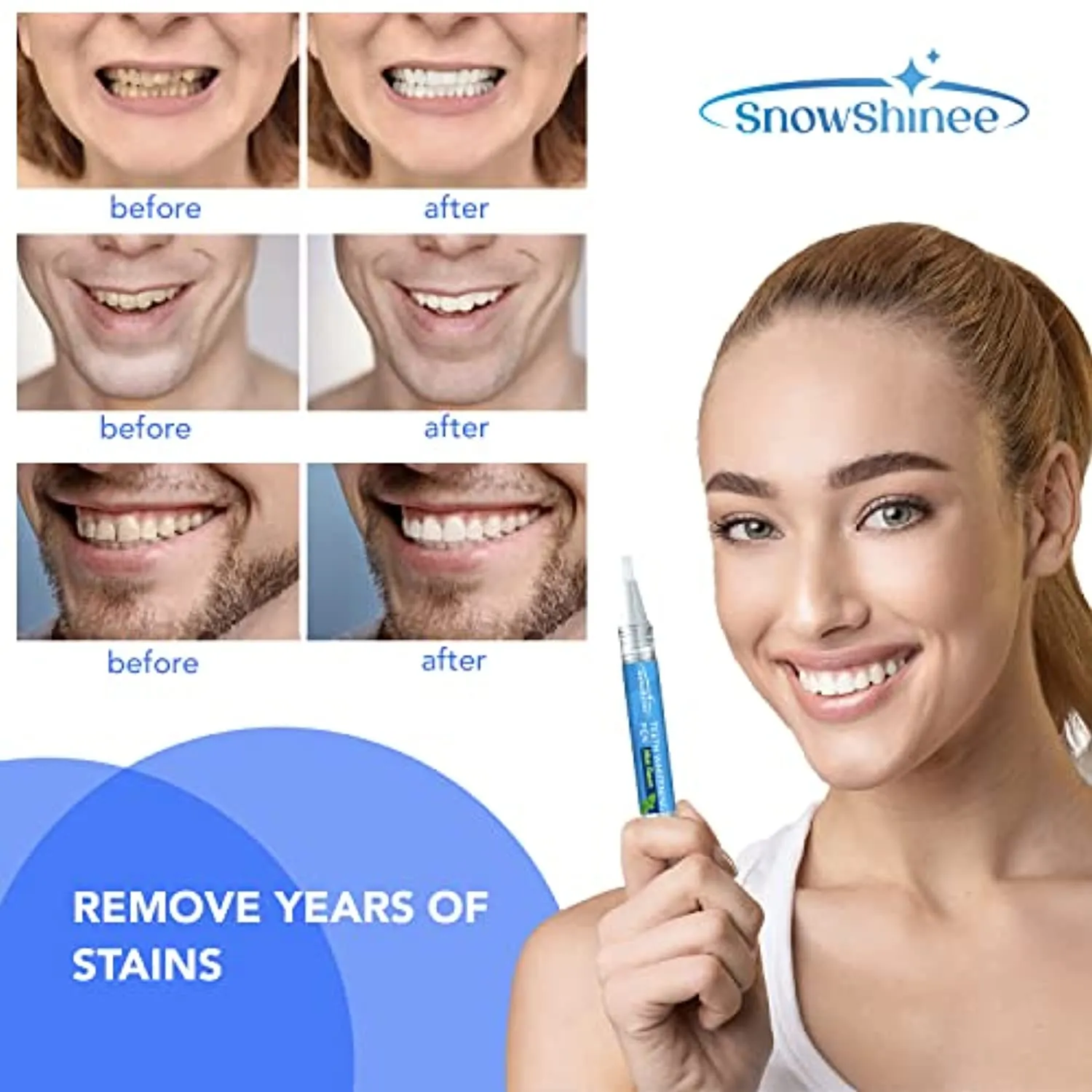 Teeth Whitening Pen - Teeth Stain Remover to Whiten Teeth - Effective & Painless Whitening, No Sensitivity, Easy to Use, Natural Mint Flavor, 2Pcs