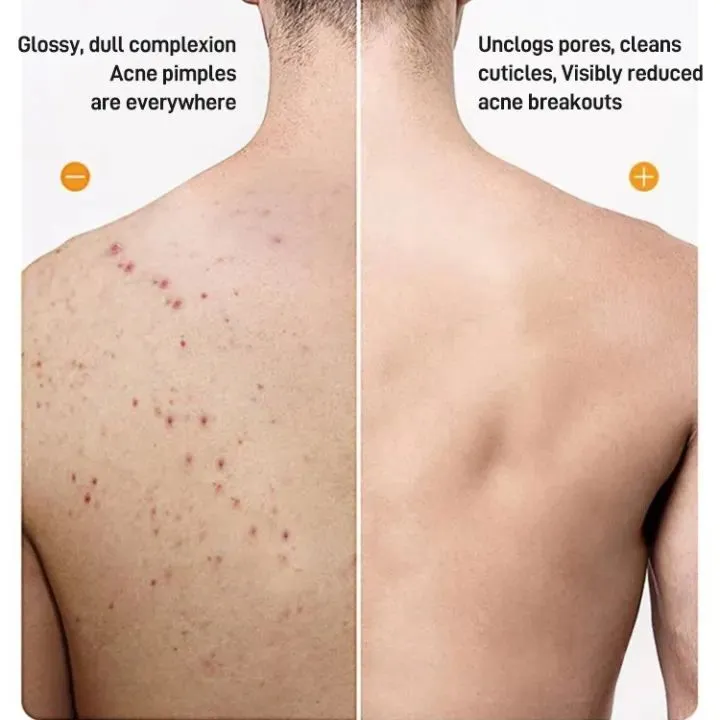Titony Sulfur mite removal liquid soap Deep Cleansing Body Wash